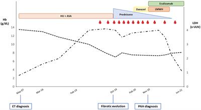 Paroxysmal Nocturnal Hemoglobinuria in the Context of a Myeloproliferative Neoplasm: A Case Report and Review of the Literature